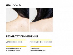 ICON SKIN ОБНОВЛЕНИЕ КОЖИ SKIN RENEWAL Обновляющий крем для тела с кислотами, 200 мл