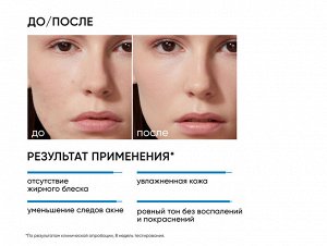 ICON SKIN Увлажняющий крем для кожи, склонной к акне Moist & Heal, 50 мл