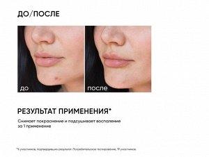 ICON SKIN RE:PROGRAM ACNE FREE Гель для точечного нанесения против воспалений SOS Treatment, 20 мл