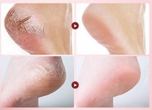 Anti-Crack крем для грубой кожи SADOER с экстрактом персика, 20 гр