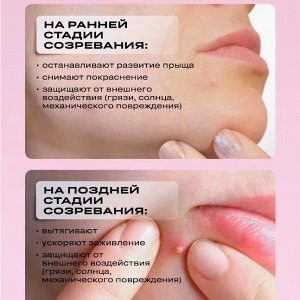 Патчи, от акне с маслом чайного дерева Эмодзи Гидроколлоидные, 18 шт, Funny Organix , 24 г,
