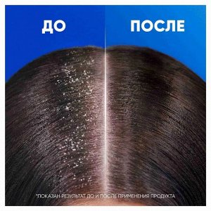 ХЕД & ШОЛДЕРС Мужской шампунь против перхоти "Old Spice" 400 мл