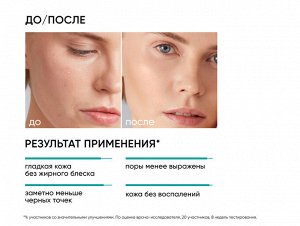 ICON SKIN RE:BALANCE T-ZONE CONTROL Пилинг 15% AHA+BHA, 30 мл