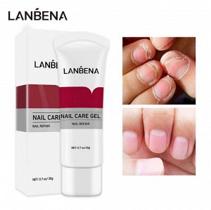 Противогрибковый крем для ногтей - nail care gel, 20гр