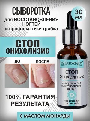 Сыворотка для восстановления и укепления ногтей СтопОнихолизис с маслом монарды 30 мл. Giorgio Capachini