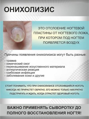 Сыворотка для восстановления и укепления ногтей СтопОнихолизис с маслом монарды 30 мл. Giorgio Capachini