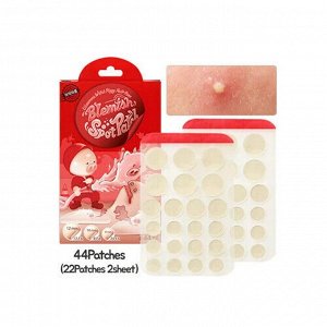 Патчи от прыщей - Witch piggy hell-pore blemish spot patch, 44шт