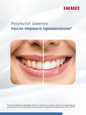 Лакалют Зубная паста защита десен и бережное отбеливание "Aktiv" 75 мл