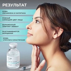Сыворотка для лица, Matrigen, с гиалуроновой килотой, увлажняющая, для мезотерапии лица руками и аппаратом, 30 мл