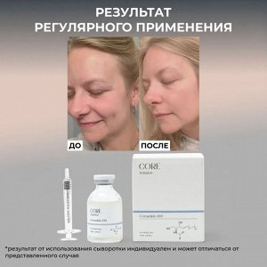 Ампульная сыворотка мезококтейль Керамиды для мезотерапии лица руками аппаратом, 30 мл