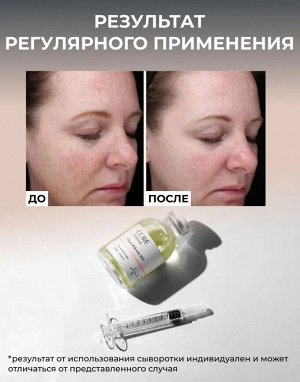Ампульная анти эйдж сыворотка Глутатион для мезотерапии лица руками аппаратом, 30 мл