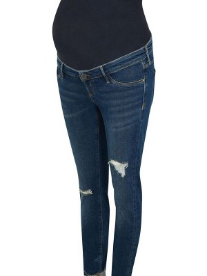 Джинсы-скинни River Island Blue Denim Molly Mat Overbump Tortellini