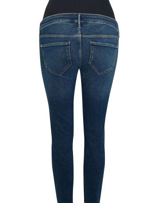Джинсы-скинни River Island Blue Denim Molly Mat Overbump Tortellini