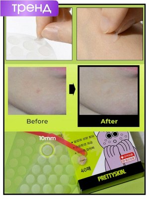 PrettySkin Патчи для проблемной кожи Spot Patch Carederm, 40шт