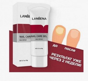 Противогрибковый крем для ногтей - nail care gel, 20гр