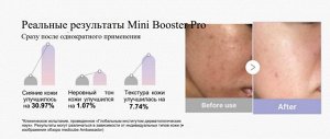 Medicube Премиальный мини-девайс для ухода за кожей лица AGE-R Mini Booster Pro MINI
