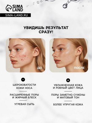 Патчи от прыщей и воспалений на лице, набор 36 шт