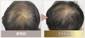 Couleur Labo Zogankin G4U Medicare Scalp - ухаживающий лосьон для укрепления и роста волос