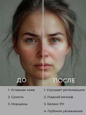 Увлажняющий тонер с гиалуроновой кислотой - LEBELAGE HYALURONIC DERMA SKIN
