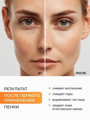 Пузырьковая пенка для умывания с пантенолом - LEBELAGE PANTHENOL BUBBLE CHEWY FOAM