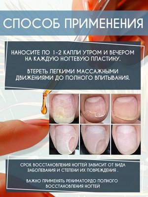 Лосьон реаниматор СТОП ОНИХОЛИЗИС Healthy Nail Reanimator Lotion Apitherapy Sagitta 30 мл