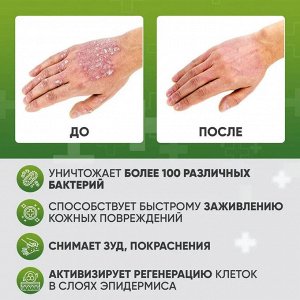 Мазь от псориаза и атопического дерматита 20г