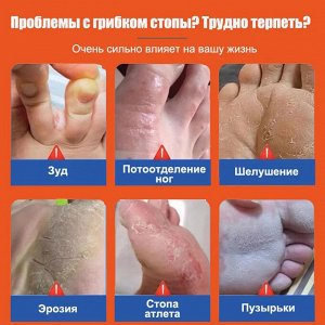 Противогрибковый крем, от грибка ногтей на ногах, от трещин, для пяток и стоп, мазь от грибка зуда, микозе 20 г