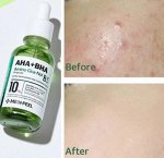 MEDI-PEEL Обновляющая ампула с кислотами и центеллой AHA BHA AMINO CICA-NOL B5 AMPOULE, 30 мл