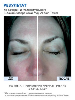ARAVIA Professional Липосомальный крем для лица RETINOL 1.0, 50 мл, Аравия
