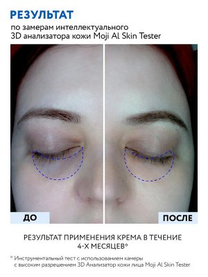 ARAVIA Professional Липосомальный крем для кожи вокруг глаз RETINOL 0.1, 30 мл