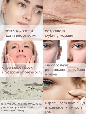 WellDerma Гальванический комплексный уход Total Care System Ems Galvanic, 1 шт
