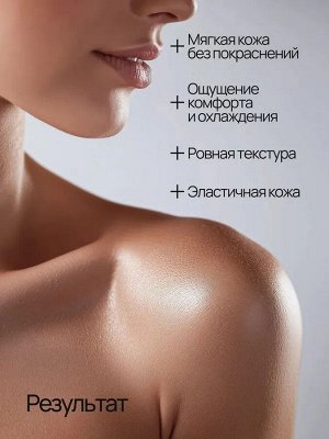 SE Спрей охлаждающий после загара, 180 мл, Гиалуроновая кислота, Пантенол, фитокомплекс Опунция, Метил Лактат.