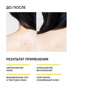 Айкон Скин Обновляющий крем для тела с кислотами Skin Renewal, 200 мл (Icon Skin, Smart)