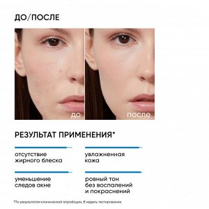 Айкон Скин Увлажняющий крем для кожи, склонной к акне Moist & Heal, 50 мл (Icon Skin, Re:Program)