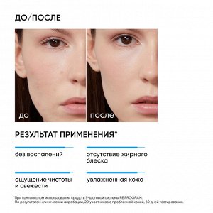 Айкон Скин Очищающий тоник-активатор Ultra Skin, 150 мл (Icon Skin, Re:Program)