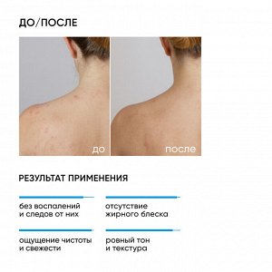 Айкон Скин Противовоспалительный очищающий гель для лица и тела Blemish Control, 250 мл (Icon Skin, Re:Program)