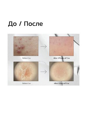 VT Cosmetics Мягкая бустер-сыворотка с микроиглами для гладкой и сияющей кожи / Midl Reedle Shot 50, 50 мл