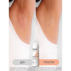 NEW ! Dove Дав Derma дезодорант аэрозоль женский спрей от запаха пота Сенситив 150 мл