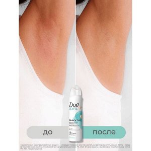 NEW ! Dove Дав Derma антиперспирант аэрозоль женский спрей от пота и запаха 150 мл