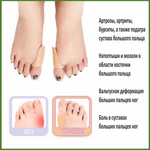 Бурсопротектор большого пальца (пара)