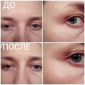 Патчи для глаз с коллагеном Корея Purederm