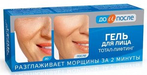 До и После л Гель "Тотал - Лифтинг" экспресс-разглаживание морщин за 2 минуты! 50мл