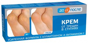 До и После ь Крем д/ног от трещин в ступнях (усиленная формула с витамином F) 150мл