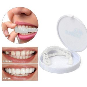 Накладные виниры Snap-On Smile.NEW