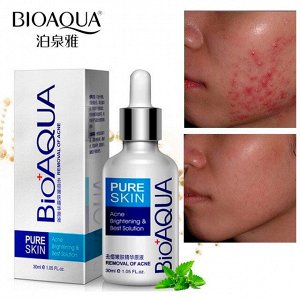 BIOAQUA, Сыворотка для проблемной кожи Pure Skin Removal of Acne, 30 мл