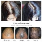 Спрей против выпадения волос LANBENA hair growth essential