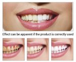 Средство отбеливания зубов Lanbena Teeth Whitening Essence