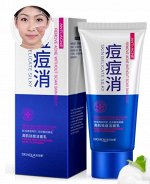 Пенка для умывания против акне Bioaqua, 100 гр