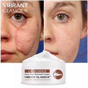 Крем для лица и тела VIBRANT GLAMOUR Crocodile Acne Scar Removal Cream с крокодиловым жиром 30 гр