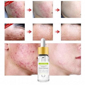 Противовоспалительная сыворотка для лица Vibrant Glamour Tea Tree Anti Acne Face Serum 15 мл